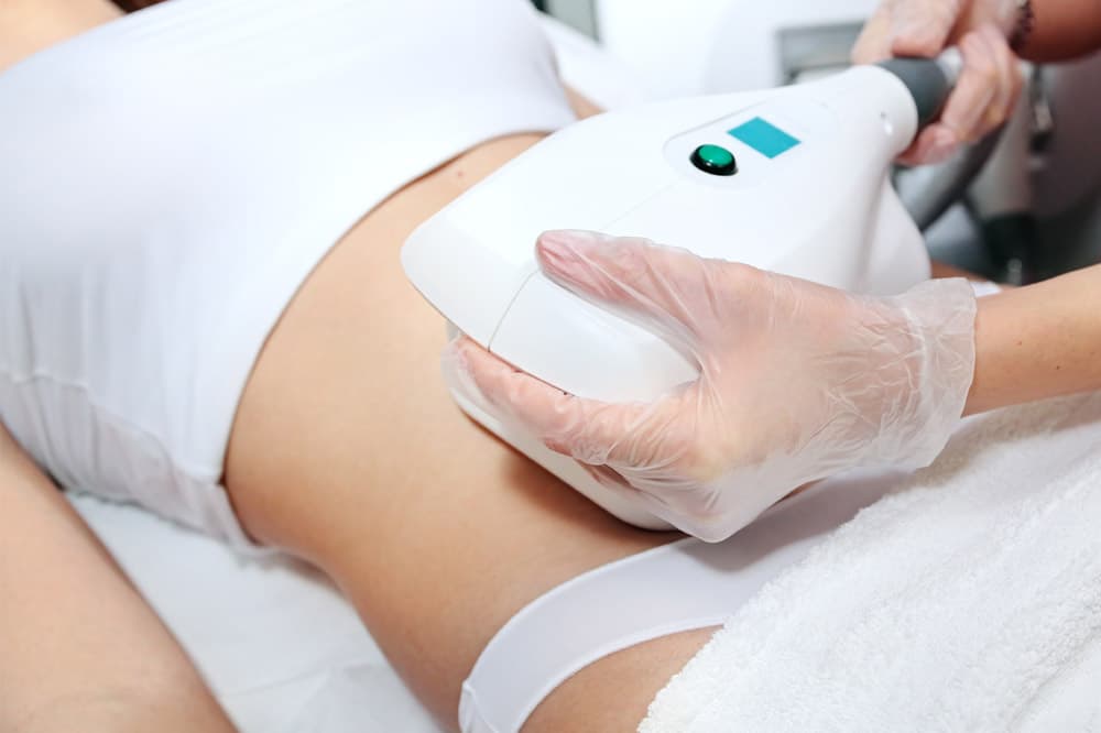 CoolSculpting before and after gallery