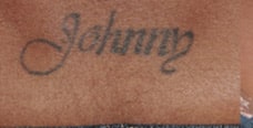 Laser Tattoo Removal — before