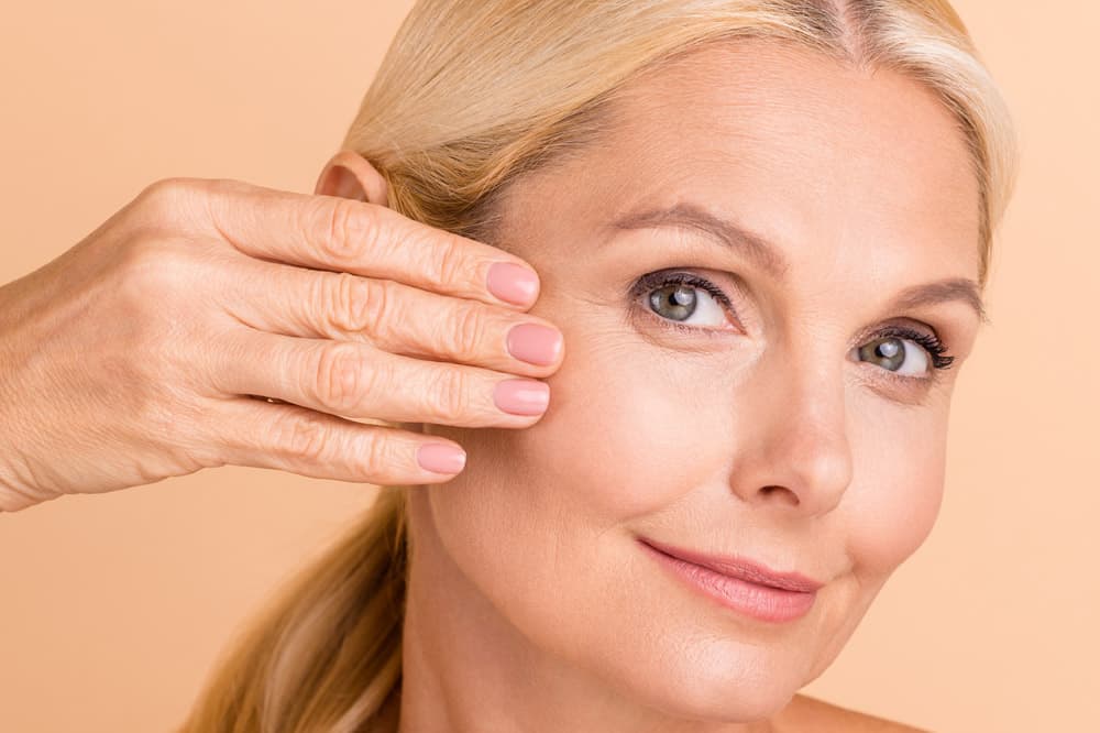 Facelift